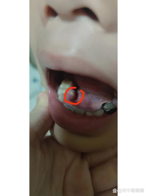 烂牙齿中间长出了多肉-第1张图片-吾爱花网