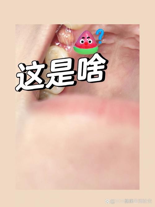 烂牙齿中间长出了多肉-第2张图片-吾爱花网